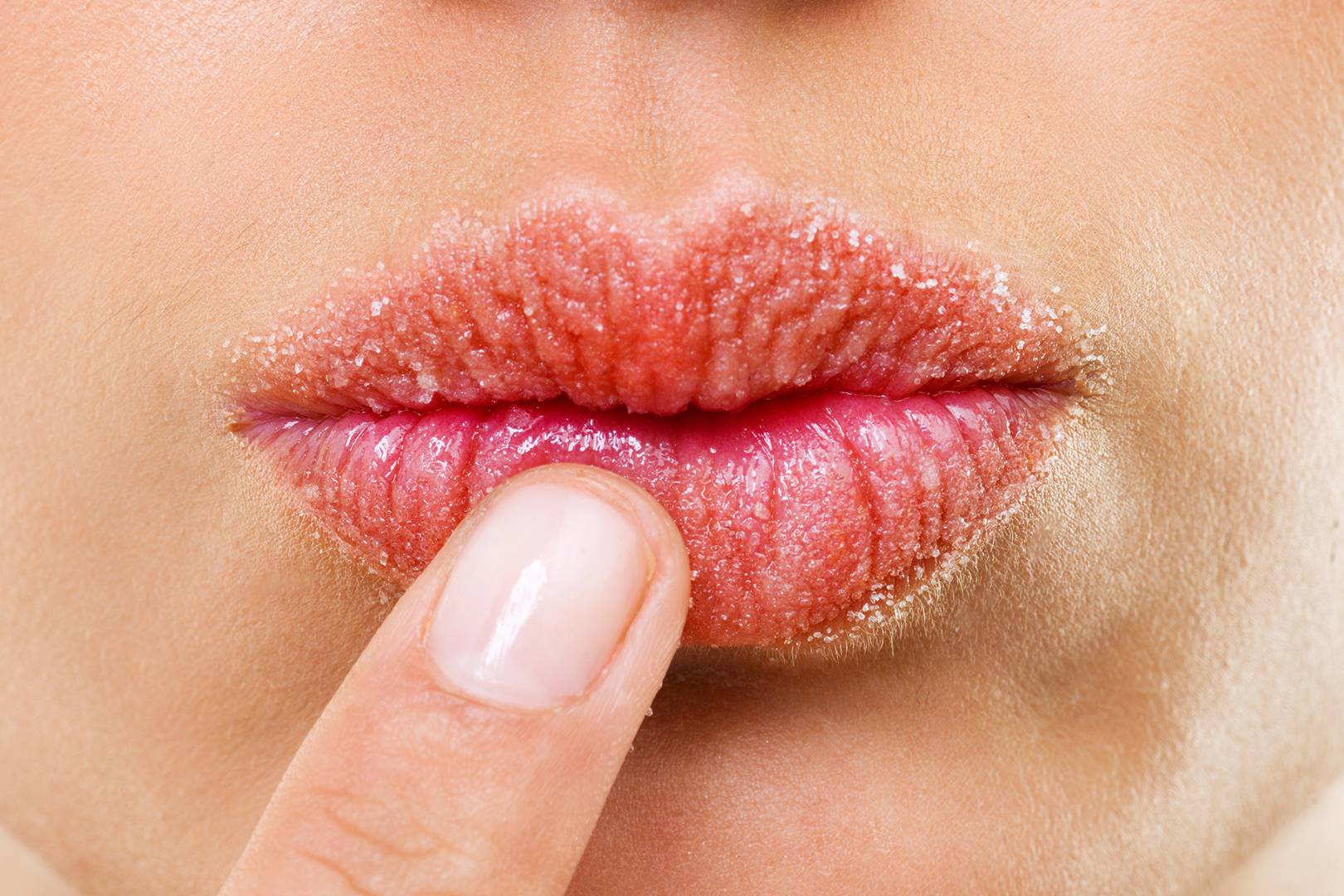 Como e o que usar para reparar lábios gretados? Remédios e receitas caseiros